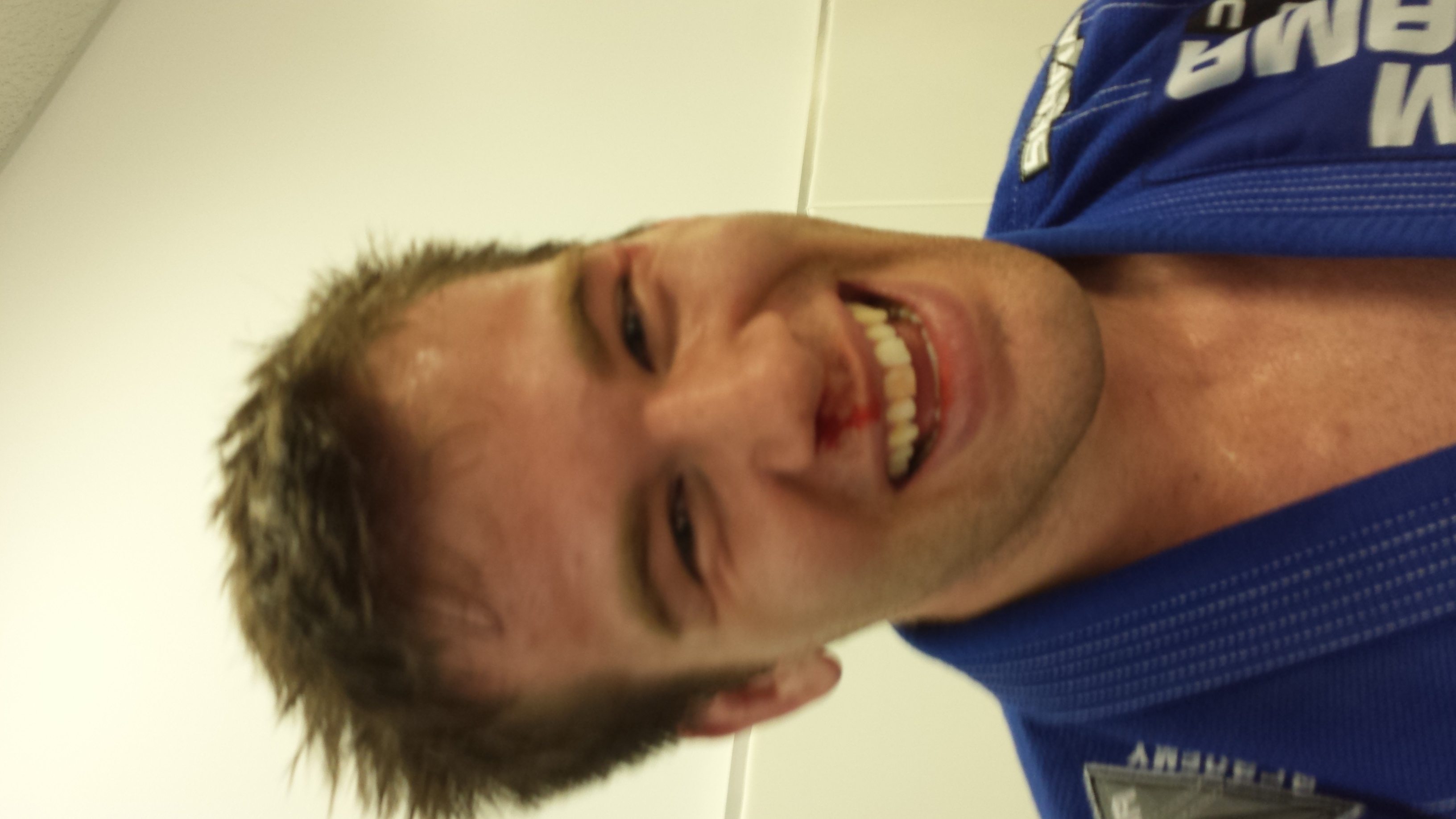 Bloodied, But Happy