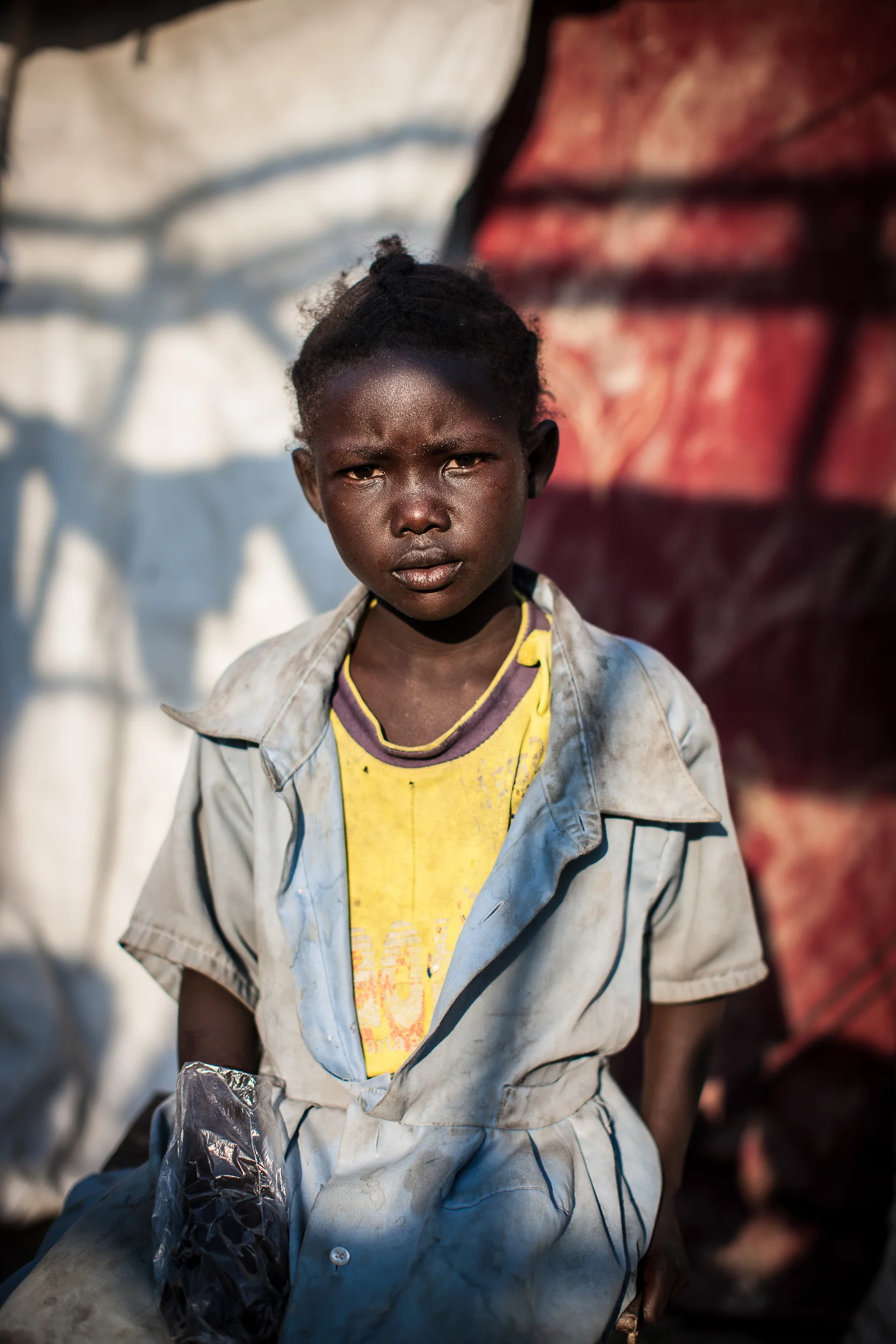 After fleeing Malakal town last year, Nyangin, 7, ran to the nearby UN base where she still lives.