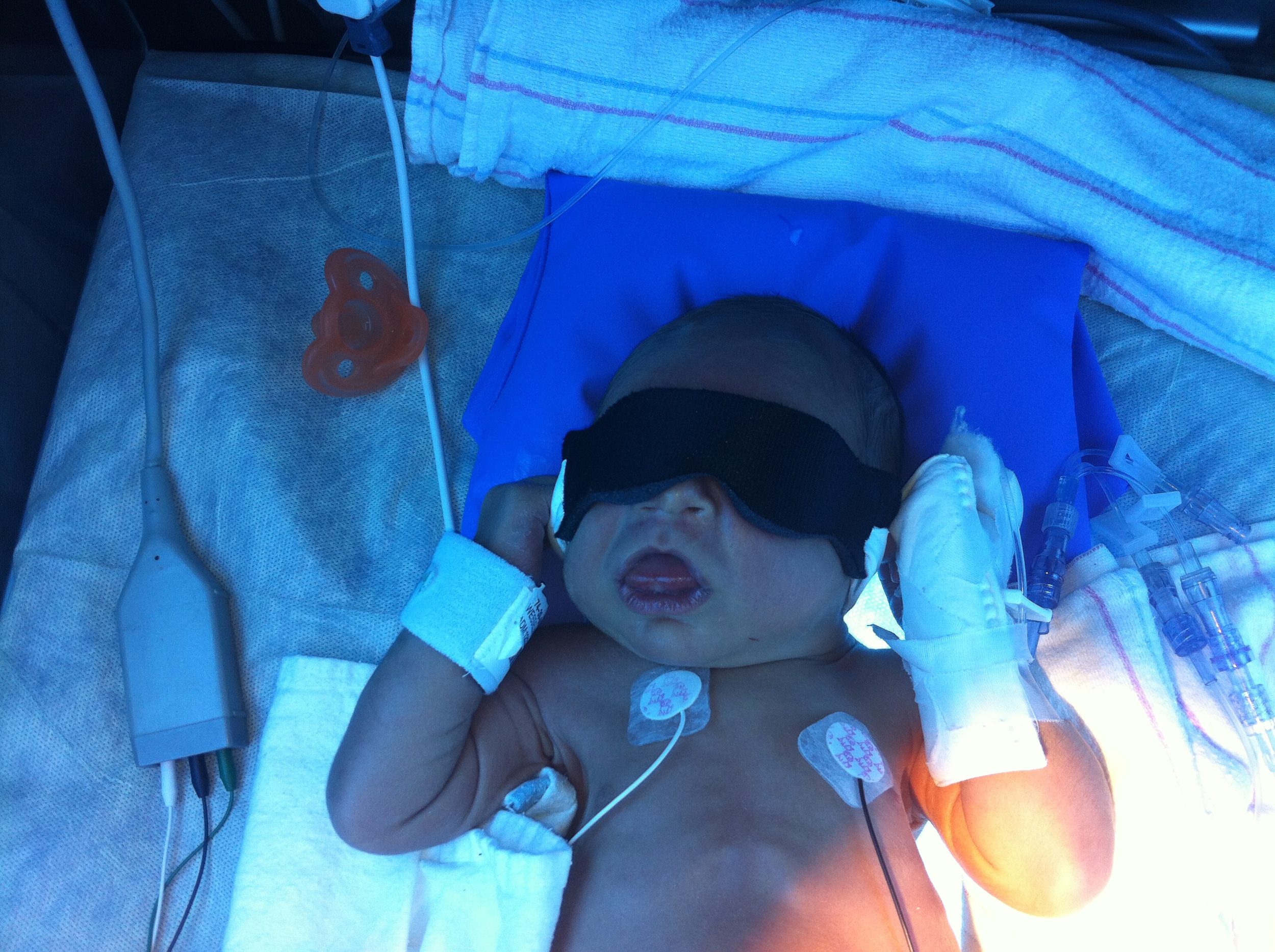 Why I'm Thankful for Jacob's Jaundice