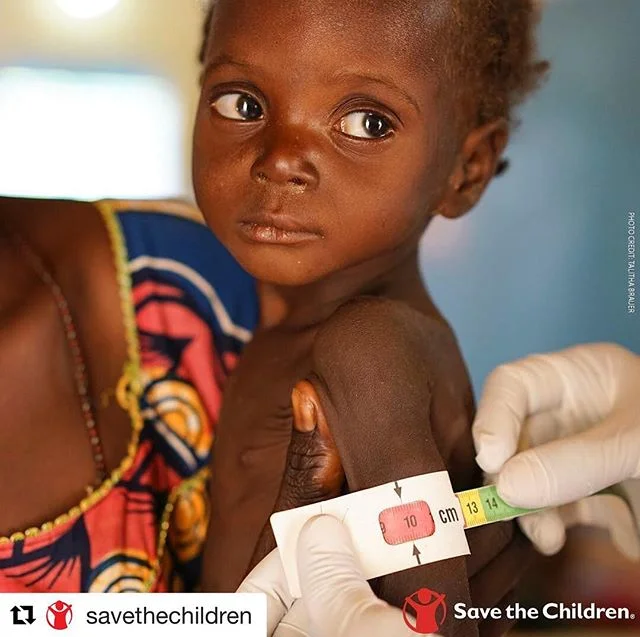#images4change #children #malnourished #famine #family #Repost @savethechildren
・・・
Nearly 1.4 million children are severely malnourished and at risk of death without immediate aid. You can help @globalemergencyresponse #FightFamine and save millions