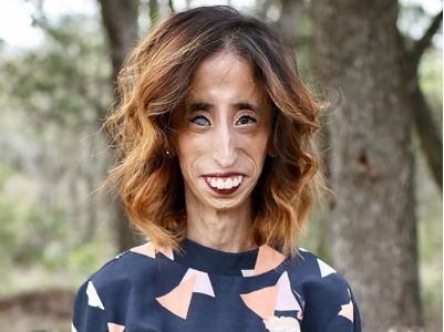 Lizzie Velasquez
