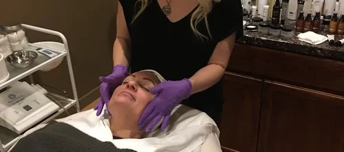 4 Signs your Skin Is Asking for a Chemical Peel