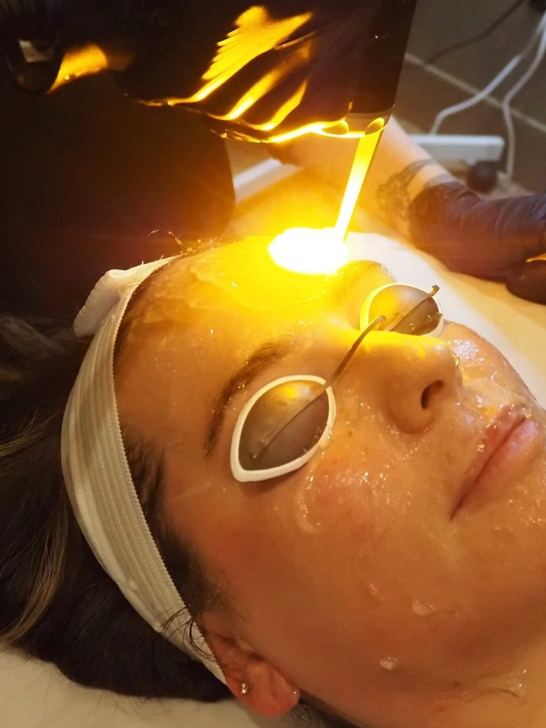 Introducing The AdvaTx Laser