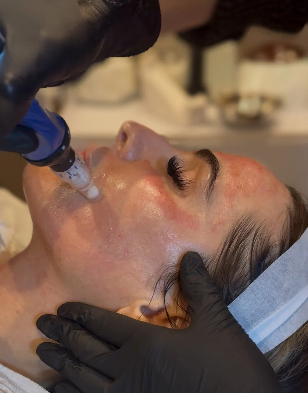How Much Collagen Do we Lose Every year?