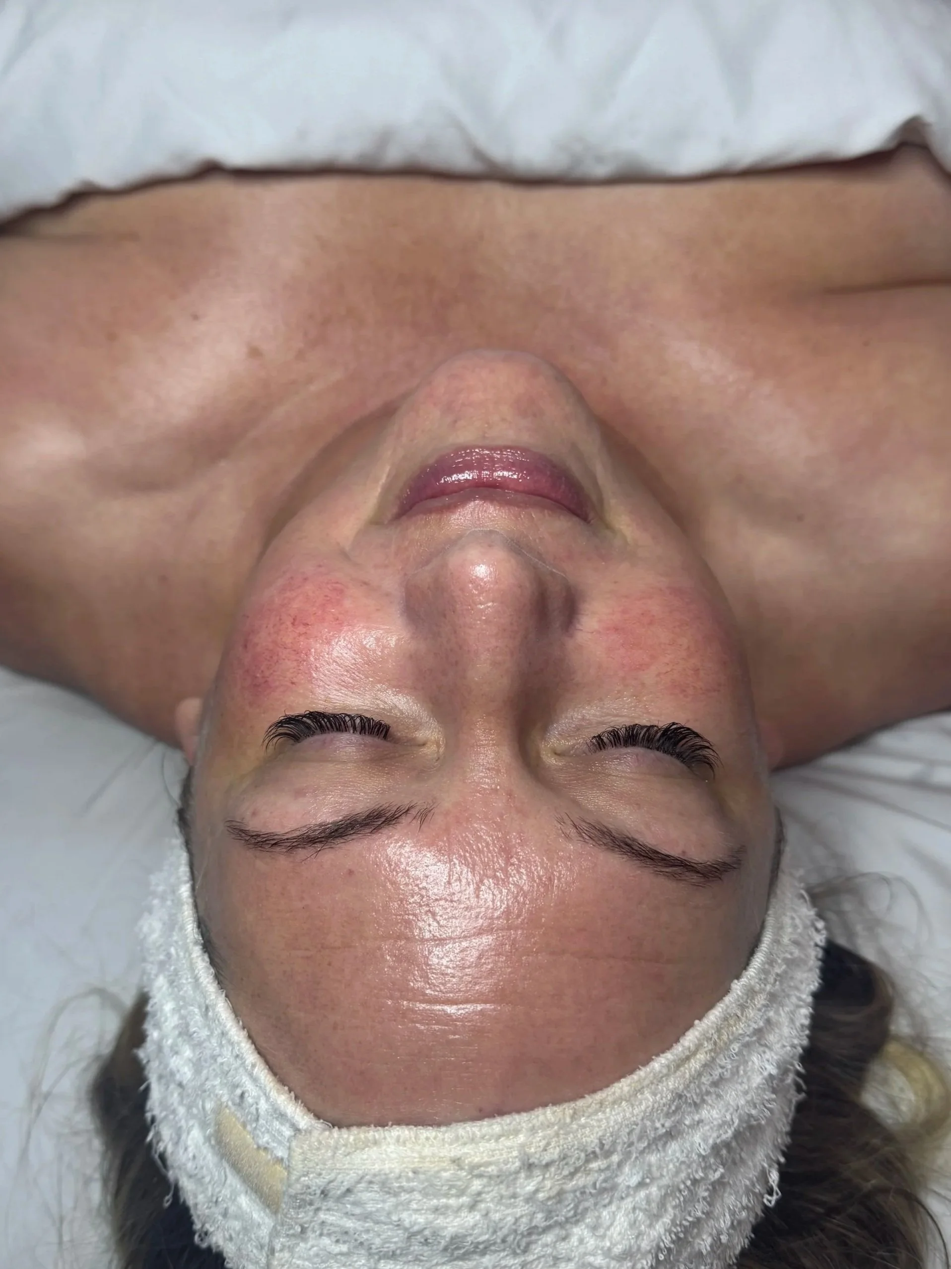 Hydration: The Key to Radiant, Healthy Skin