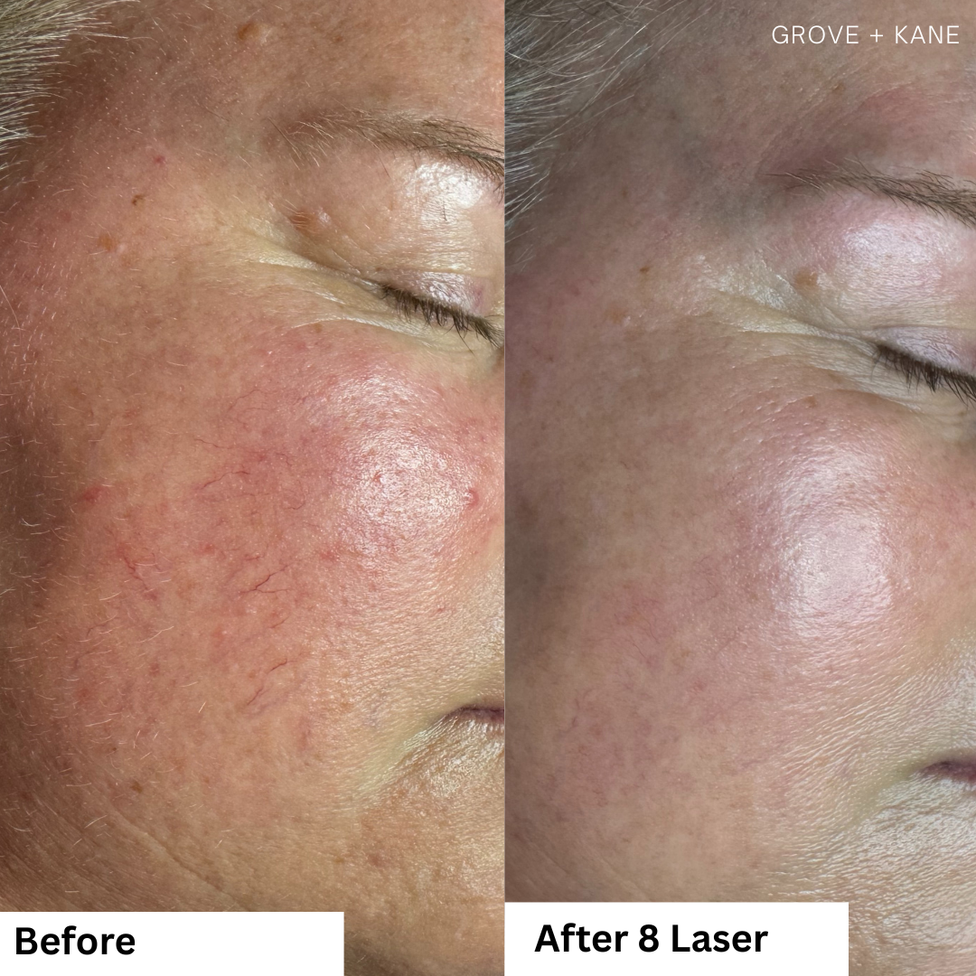 Rachel Cottingham Approved 2.PNG