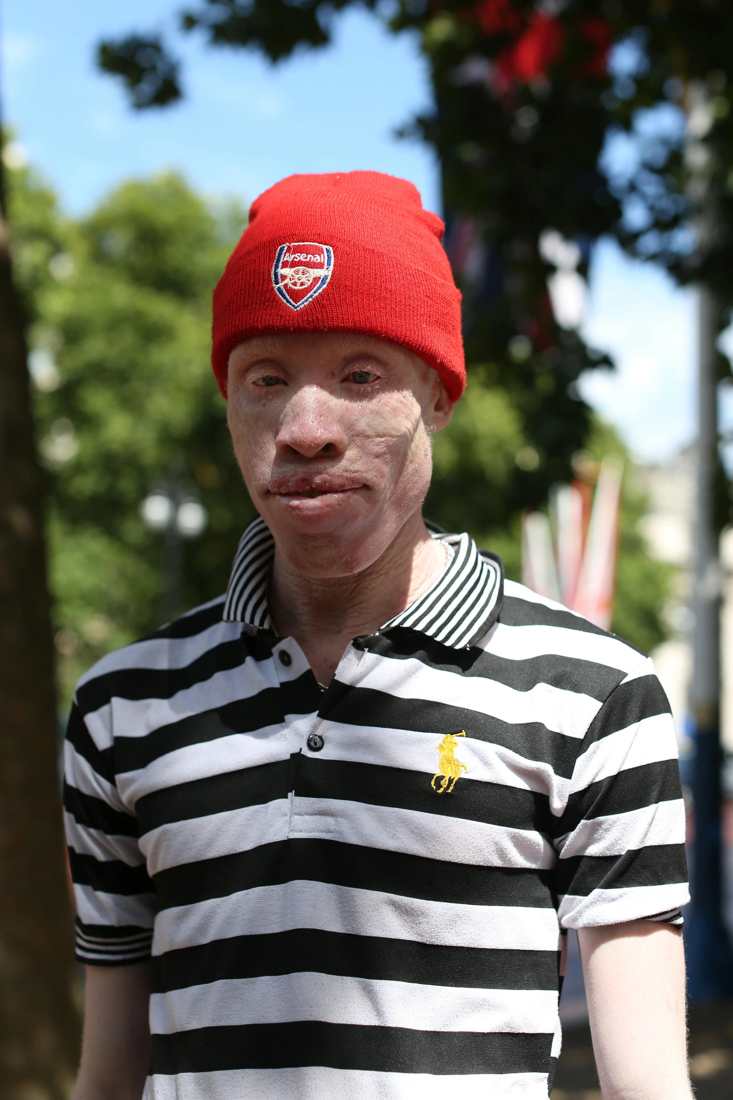 The Albinism Collective. Standing Voice . 2017