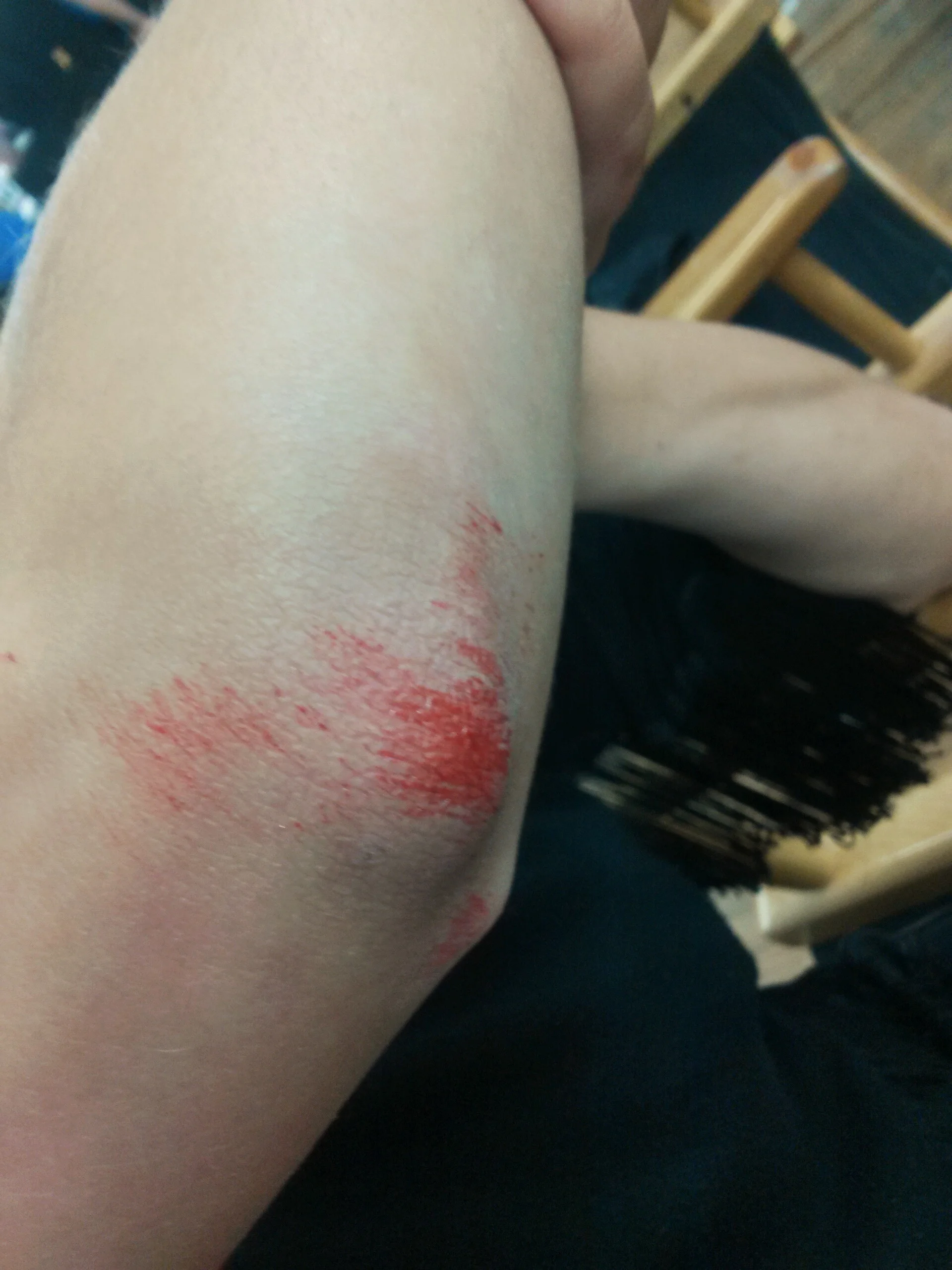 minor scrape