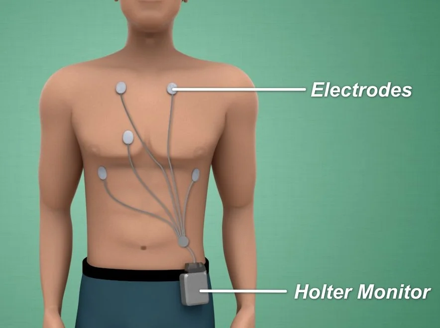 10_HolterMonitor.jpg