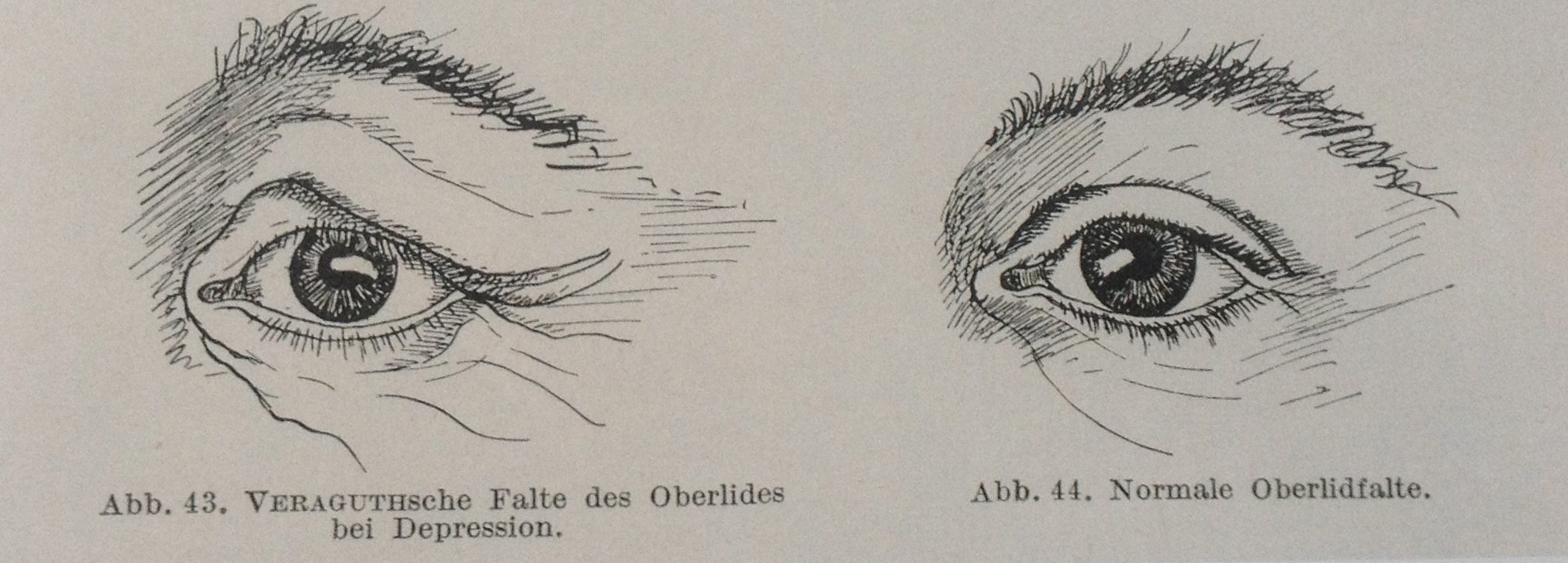 Eugen Bleuler, Lehrbuch der Psychiatrie, 1916
