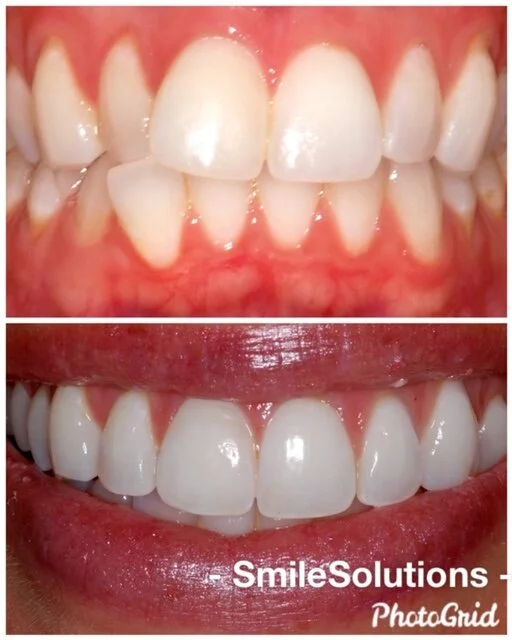 Unhappy with your Smile?  Not sure what happens next?