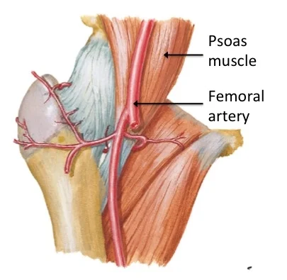 Image 3: This is a view of the front of the right hip joint, showing the relationship of the psoas muscle and femoral artery.