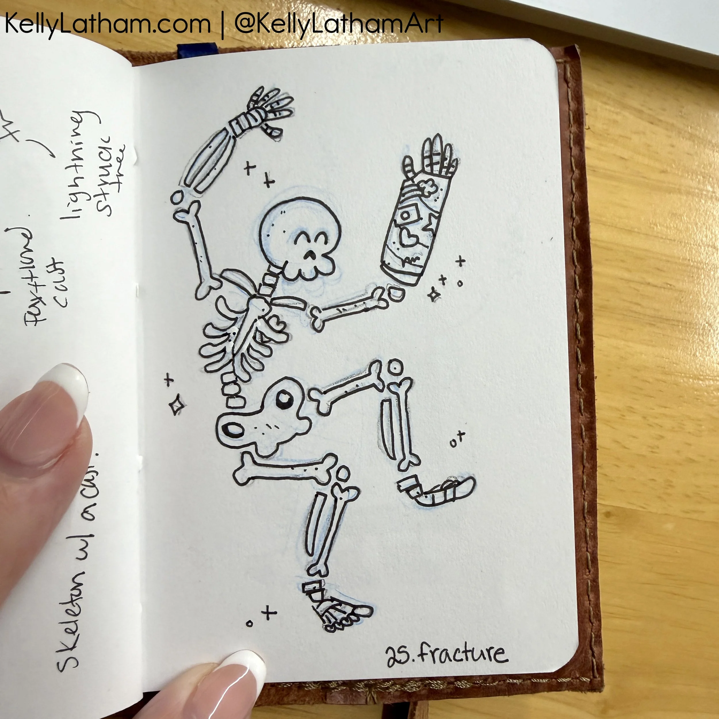 25 fracture.JPG