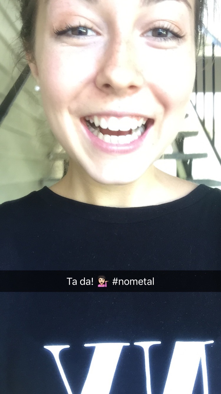 Braces Off!!