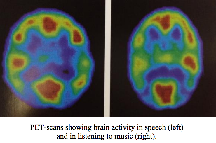 Image from Dementia care, Alzheimer's Association