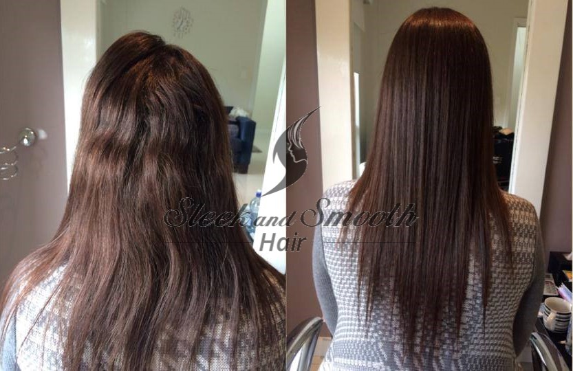 12 Months Later back to treat the re-growth