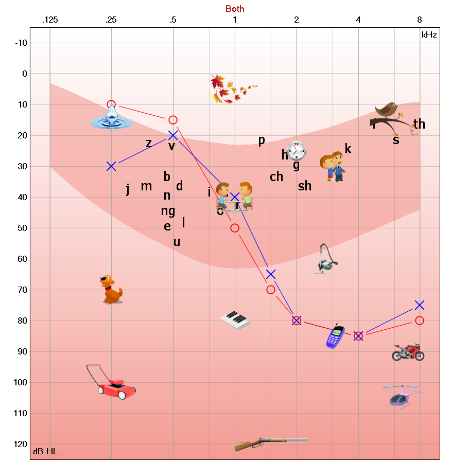 NIHL_audiogram