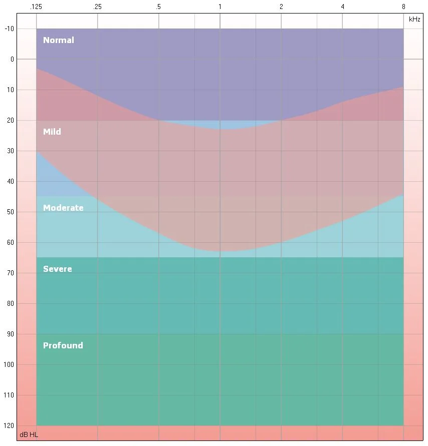 This image shows an audiogram with the degrees of hearing loss overlayed.  An audiogram is used to plot the softest sounds that a person is able to hear in each ear across the frequency range of human speech. For more information on how we test hearing and interpret audiograms,&nbsp;see  Hearing Assessment .
