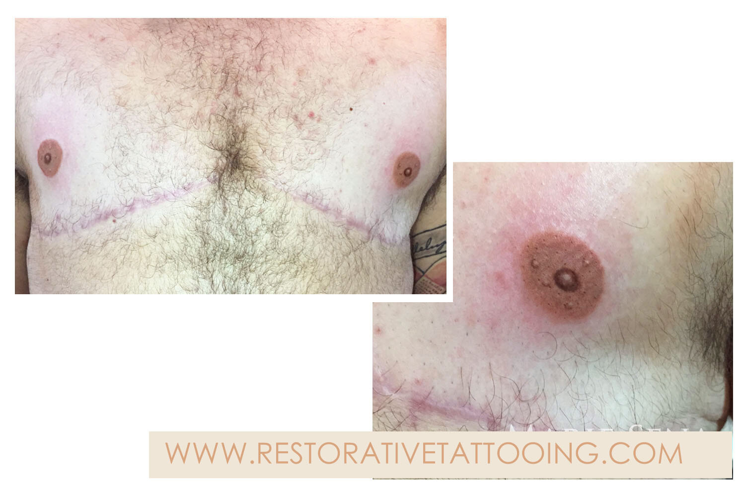 Masculine Areola Tattooing
