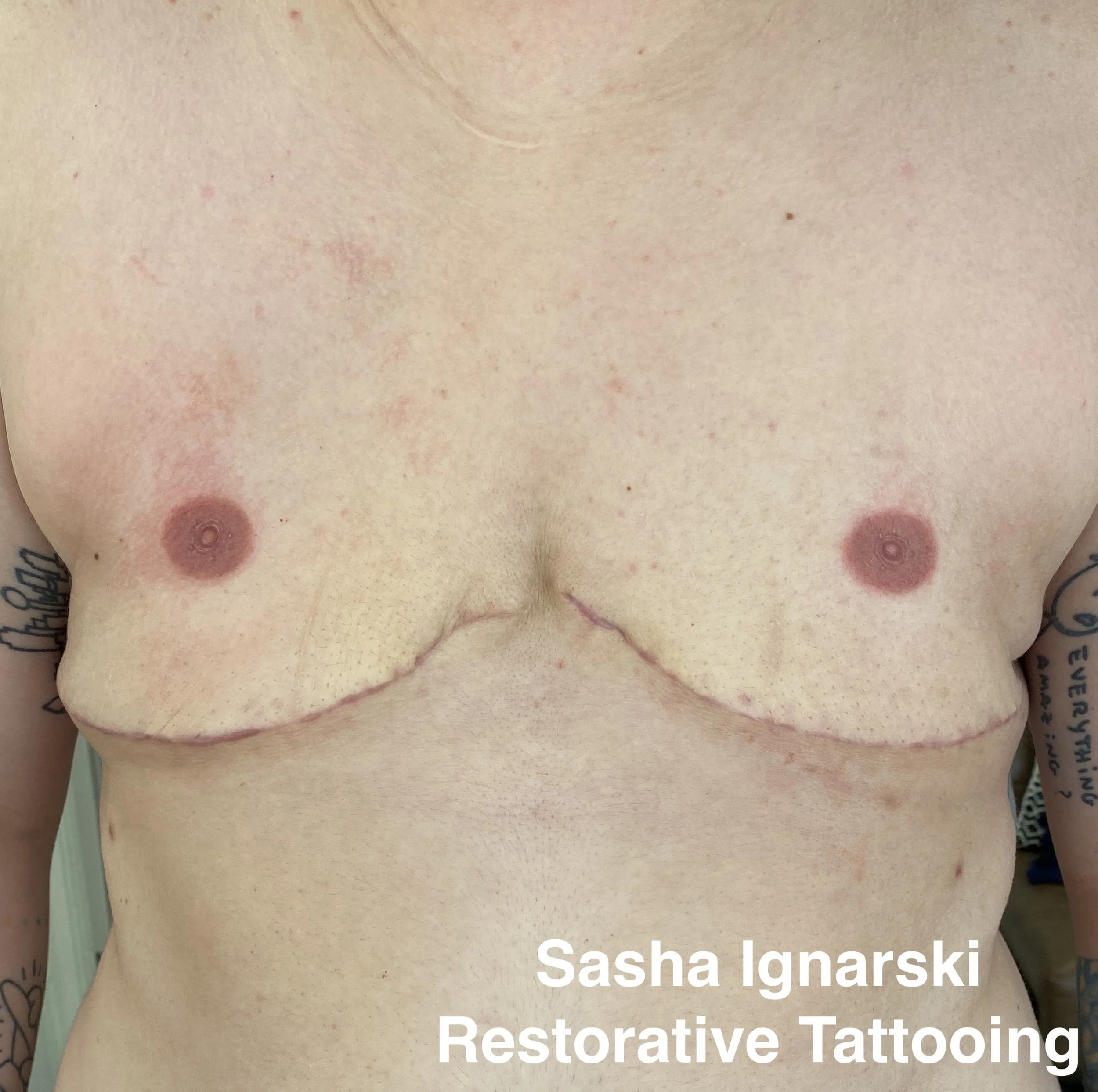 Masculine 3D areola tattooing by Sasha Ignarski, Restorative Tattooing