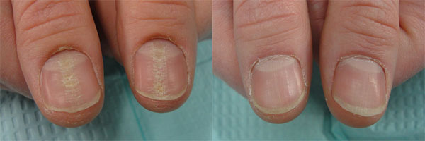 What Is The Secret Of The Perfectly Groomed Cuticle? | Cuticle care, Nail  care tips, Nail care
