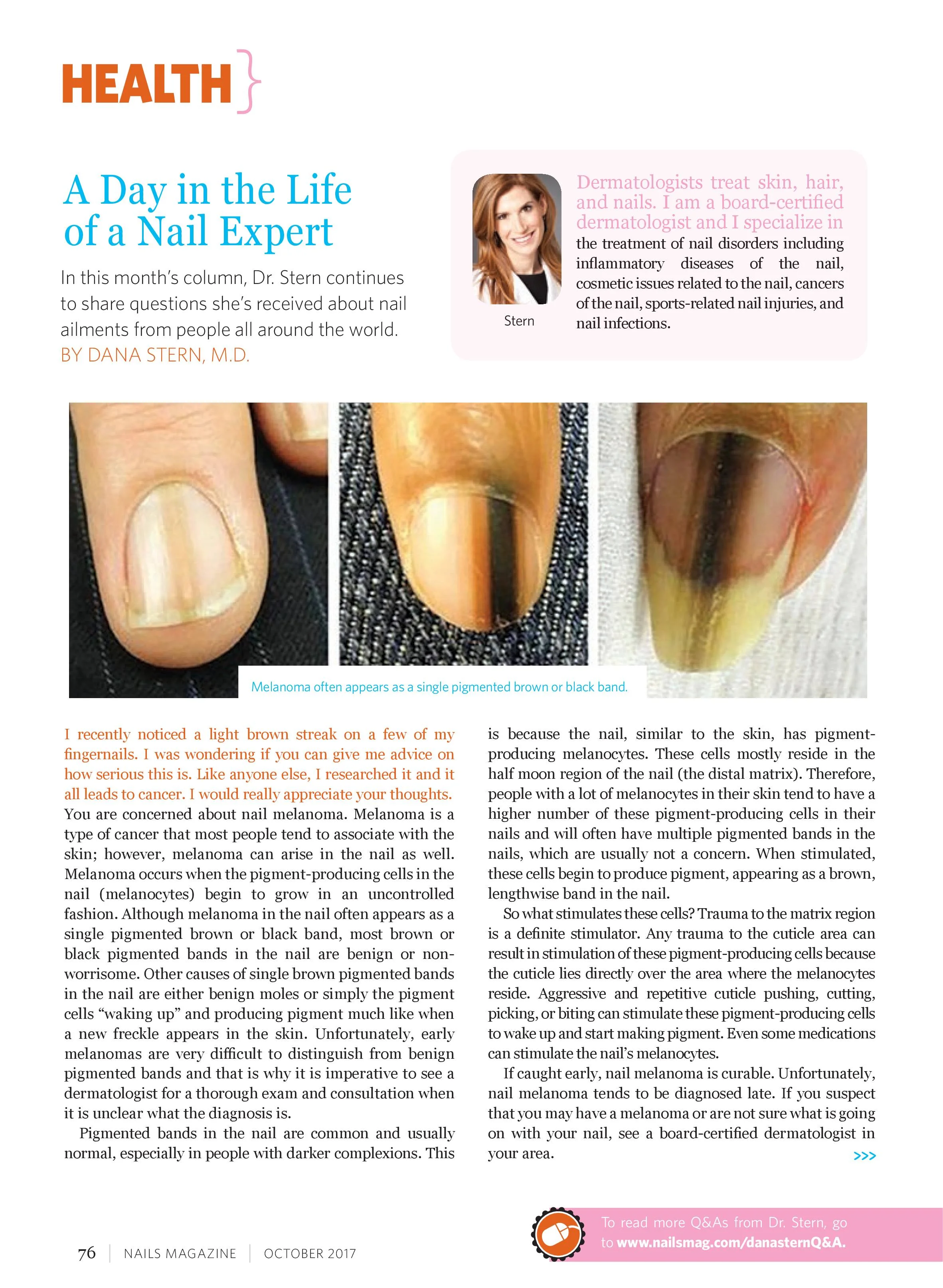 Nail Melanoma — Dr. Dana Stern Dermatologist Nail Specialist