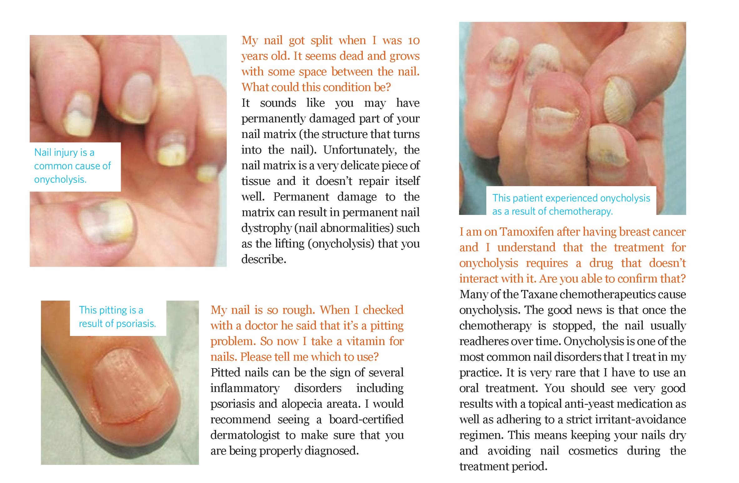 How a Weak Immune System Can Cause Nail Problems: Francine Rhinehart, DPM:  General Podiatrist