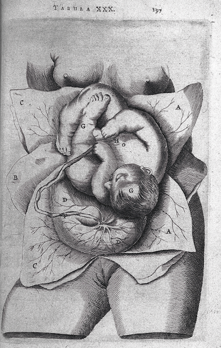 (T. Bartholin, puellum nudum, tunicis omnibus. Credit: Wellcome Collection. CC BY)