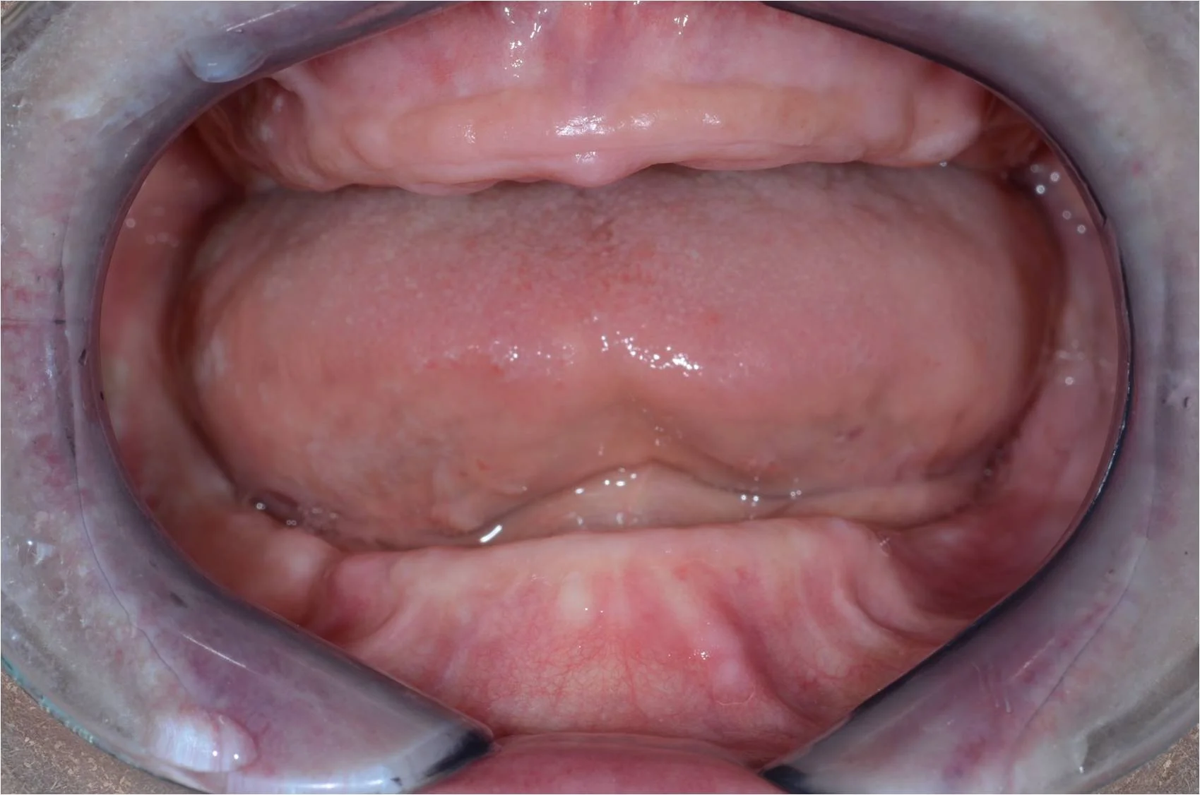 Initial consultations evaluate patients existing teeth and bone.