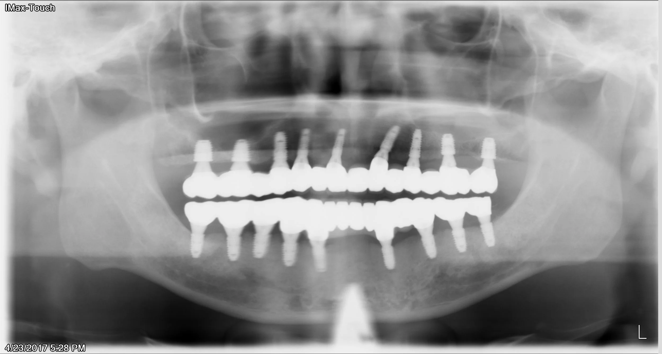 3DigX_04232017_172841 Copy.jpg