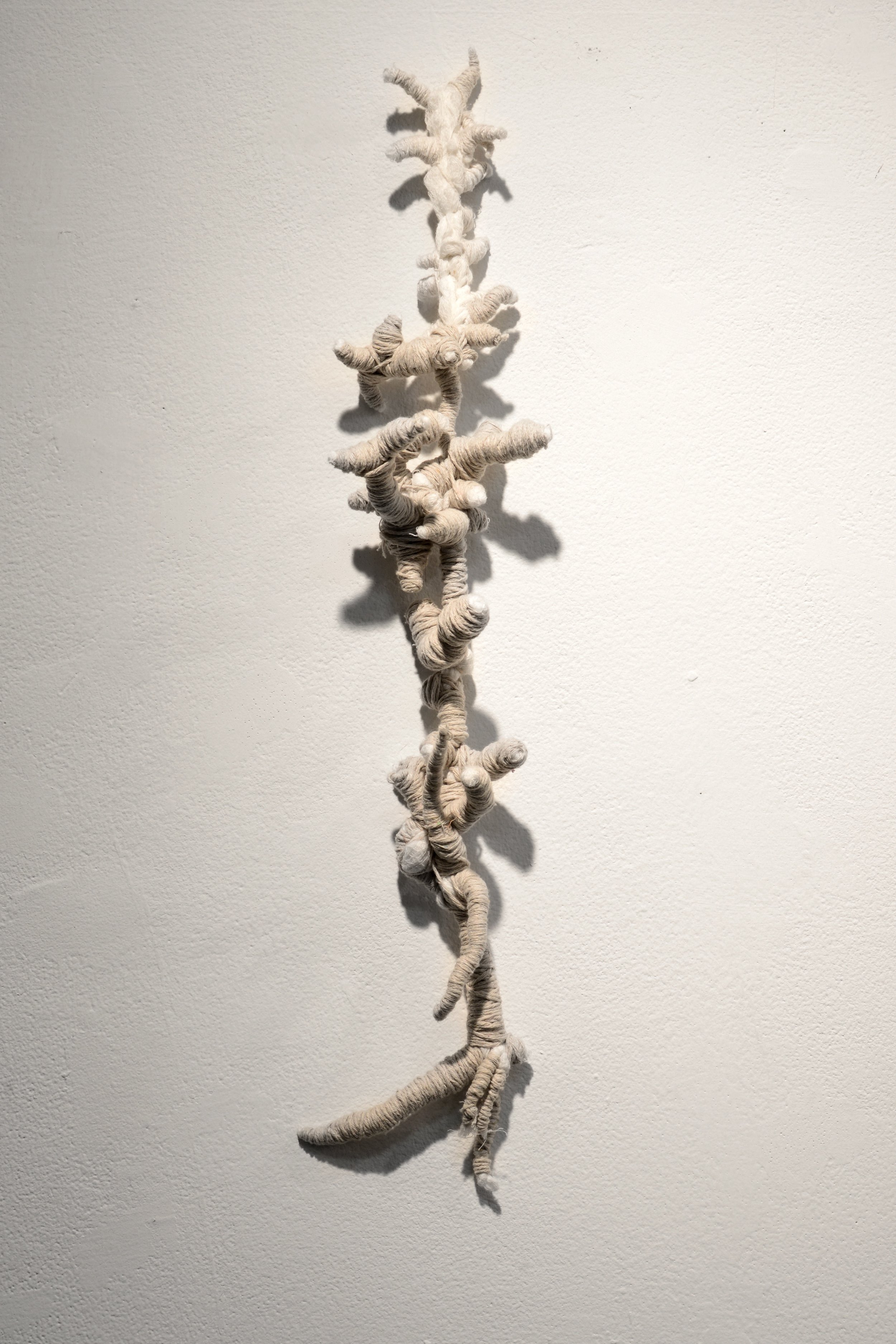 Gingerly Wound Yasmeen Abdallah