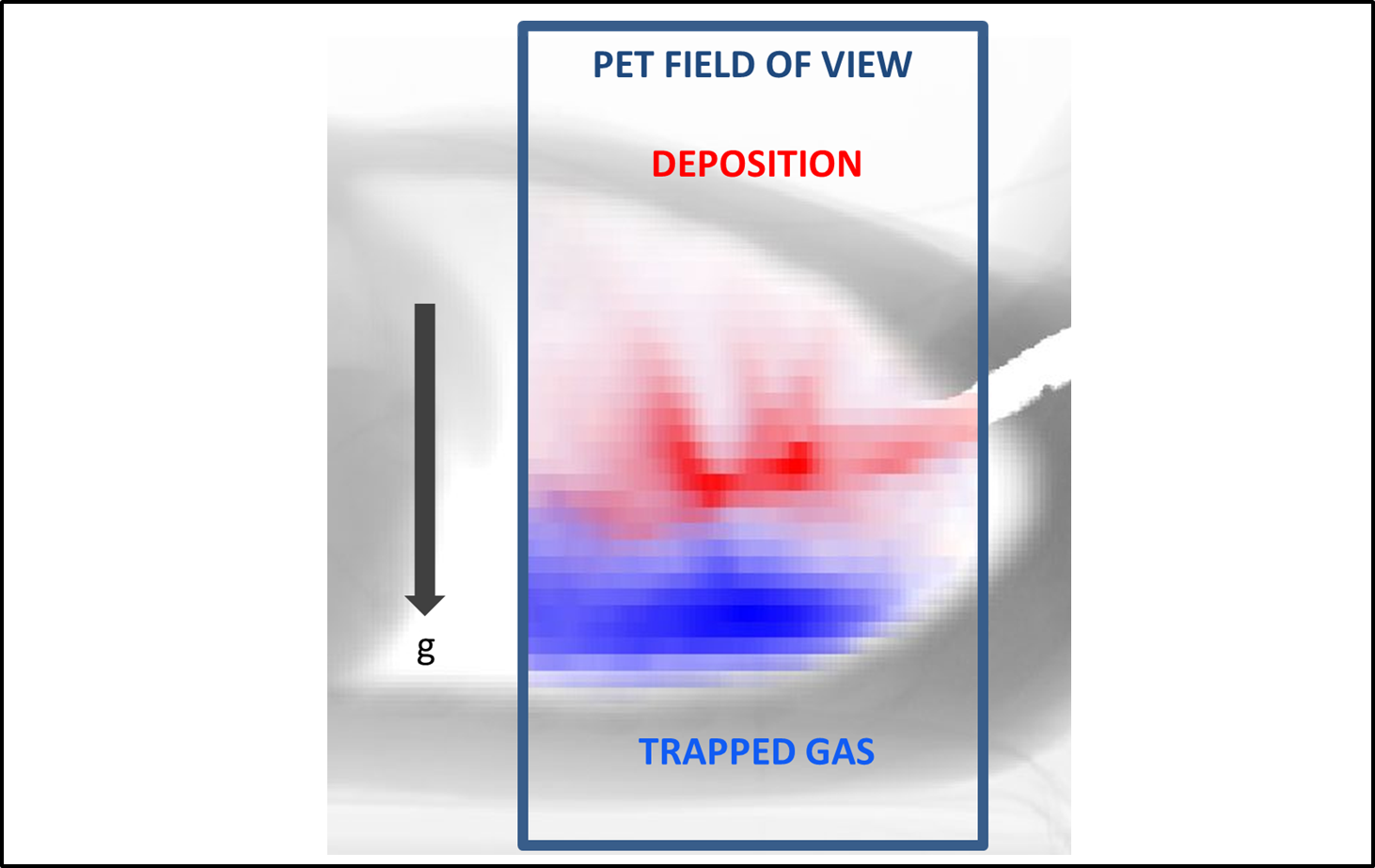 Ventilation and Aerosol Deposition