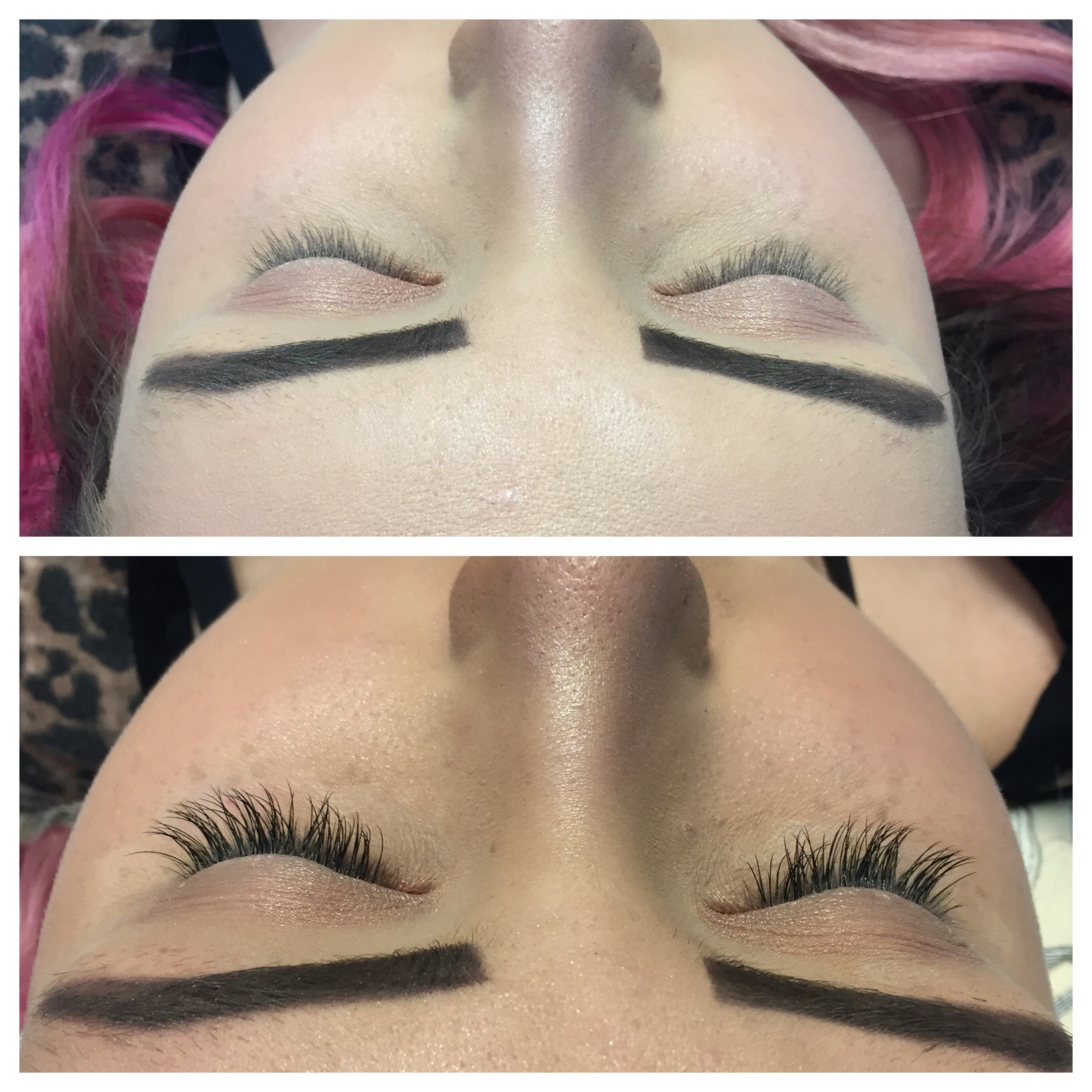 Before and After