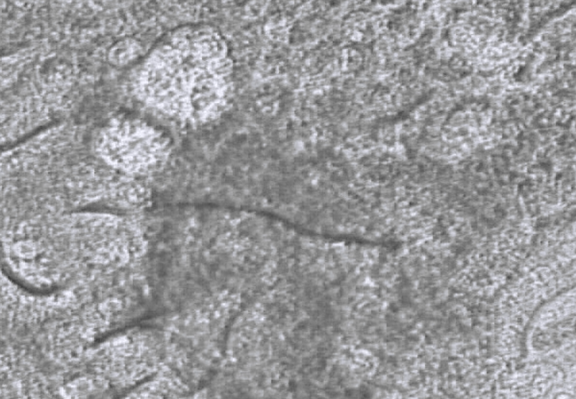mucus+cell+culture.png