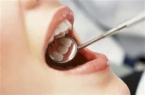 teeth.jpg