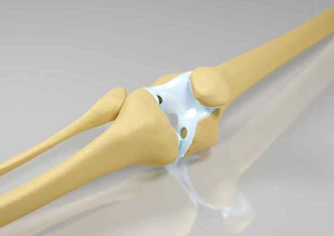 anatomical knee model
