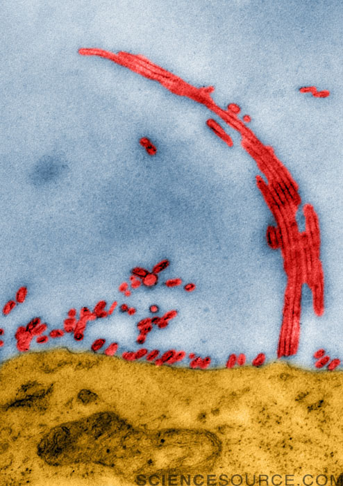 TEM of Influenza Virus