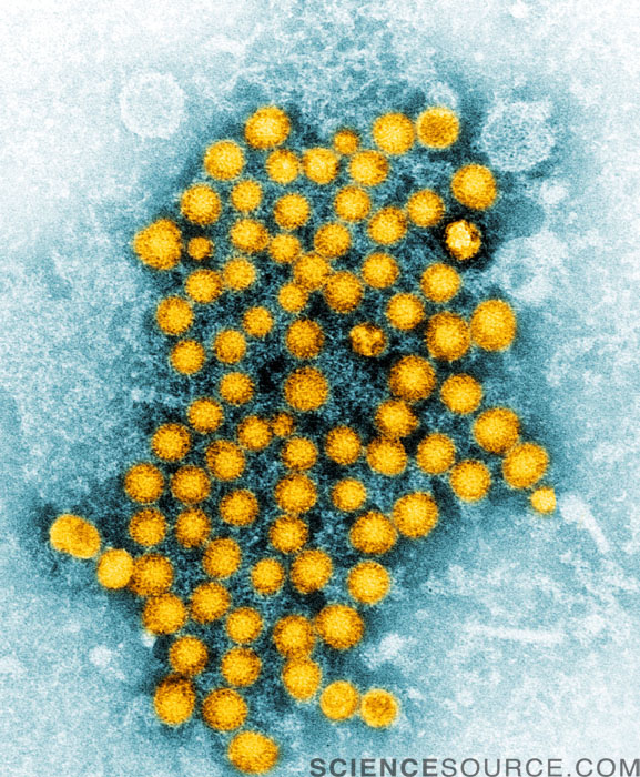 Hepatitis Virus, TEM