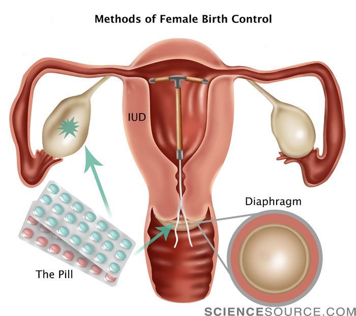 Female Birth Control