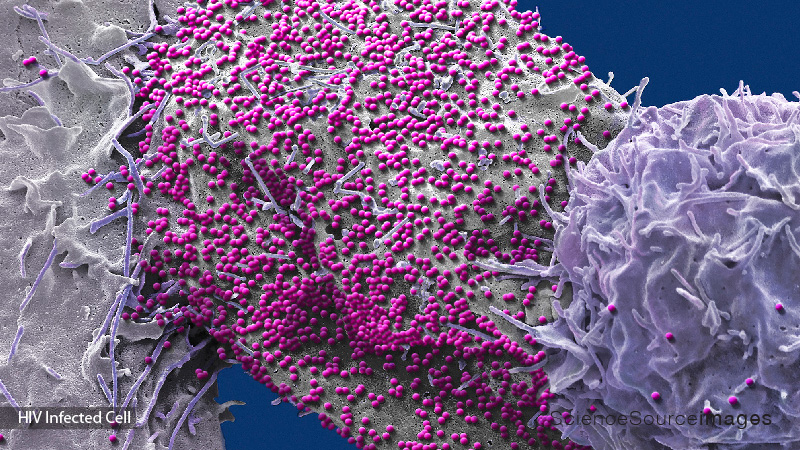 HIV INFECTED CELL, SEM