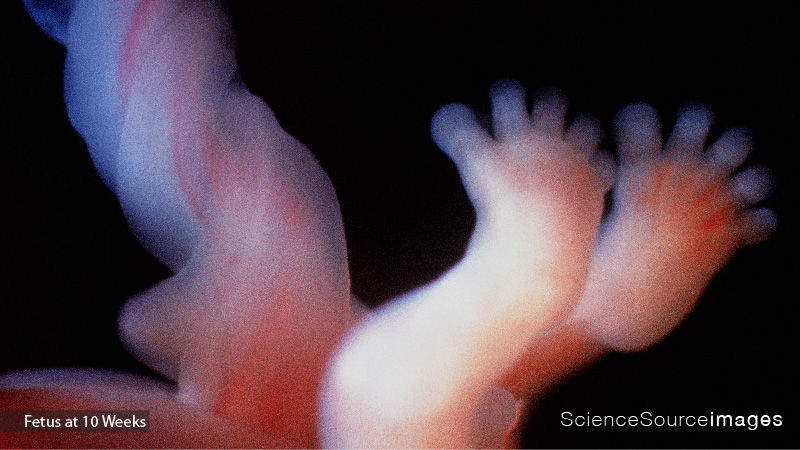 Photo of a 10 Week Old Fetus, Feet and Umbilical Cord