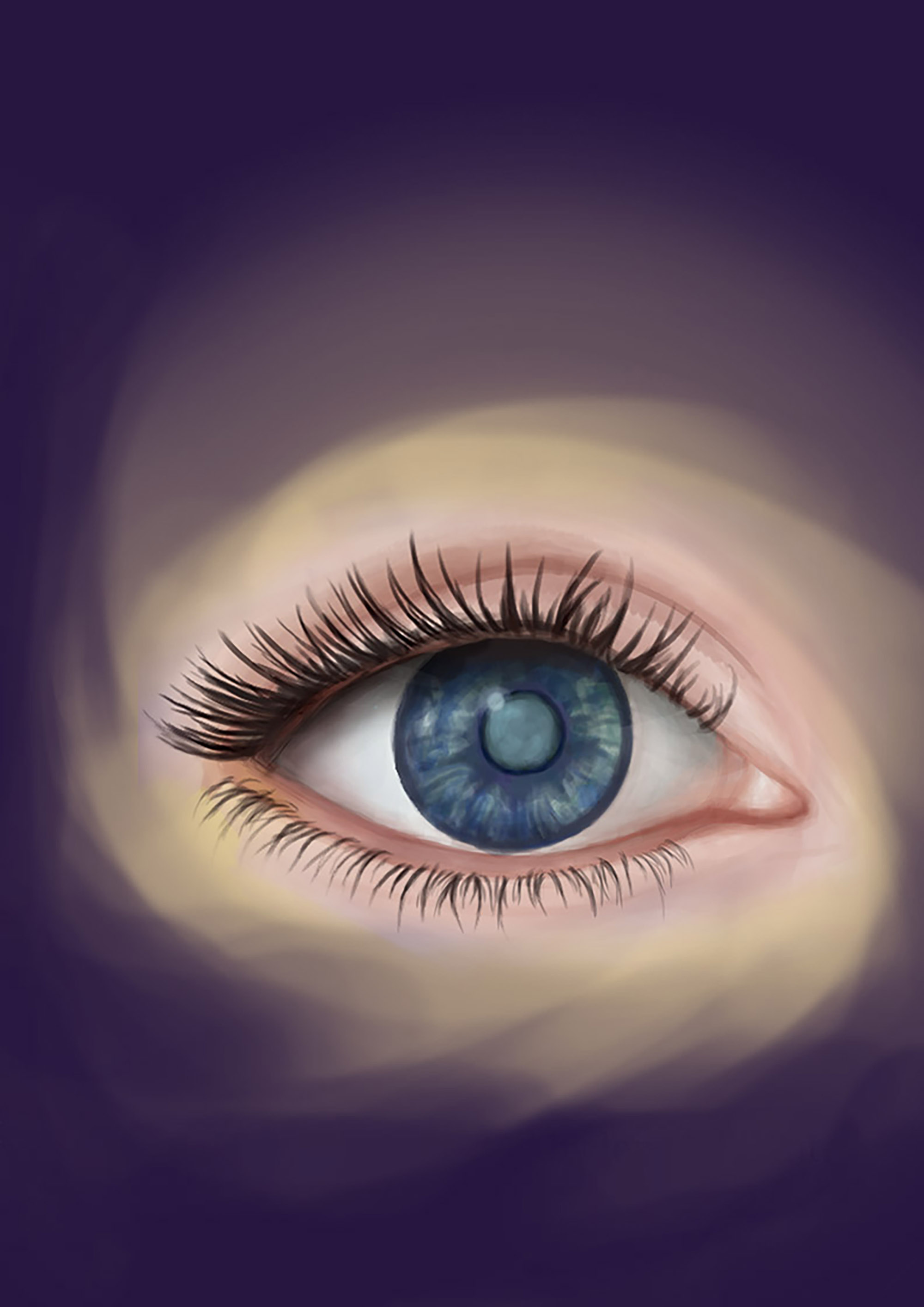 Cataract, Illustration