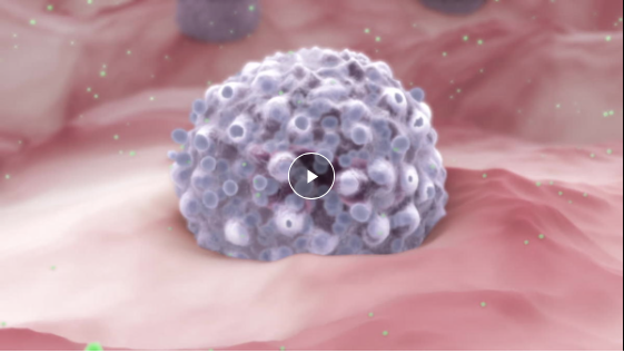 3D Animation of cancer, Mast Cell