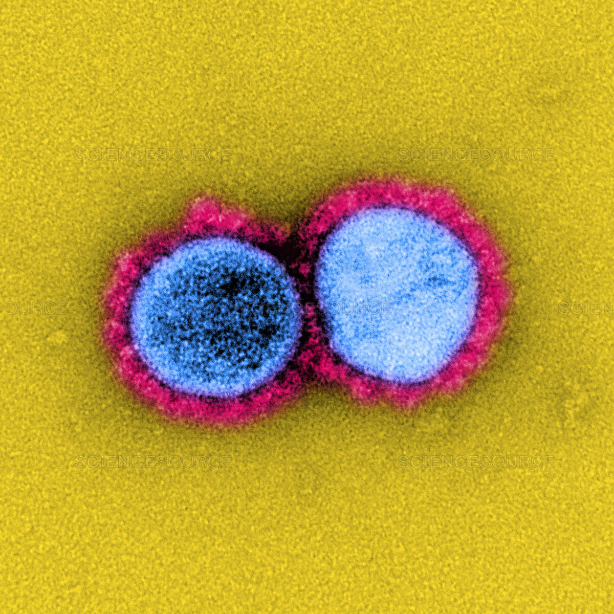 SARS-CoV-2 virus