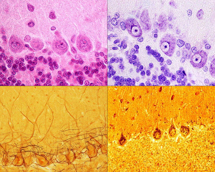 Purkinje neurons of the cerebellar cortex stained with four staining methods: hematoxylin eosin (top left), cresyl violet (top right), Cajal's silver nitrate (bottom left) and silver method for Golgi apparatus (bottom right). © Jose Luis Calvo/Science Source