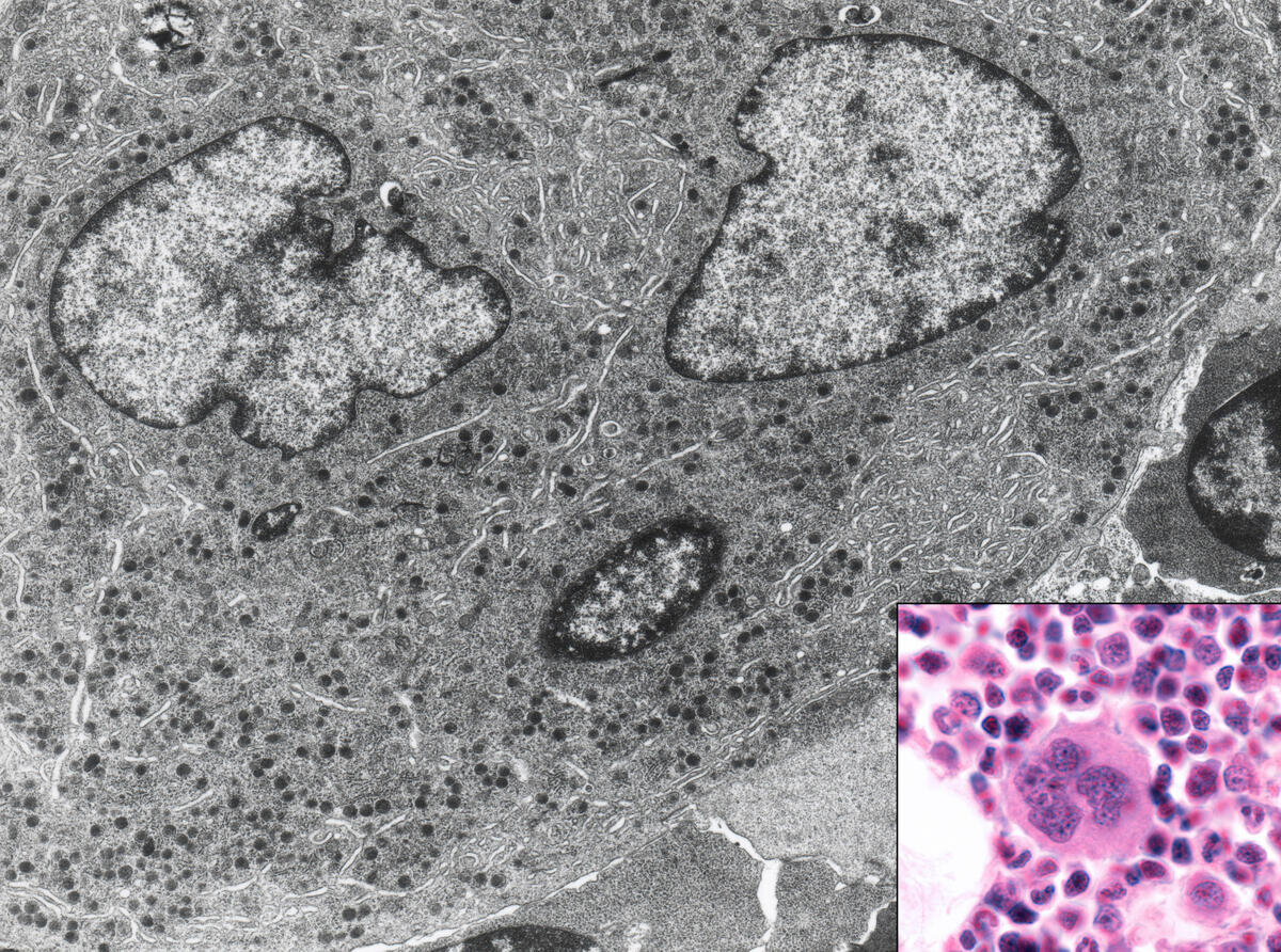 Bone marrow cell. This micrograph shows this cell with light (inset) and electron microscope. © Jose Luis Calvo/Science Source