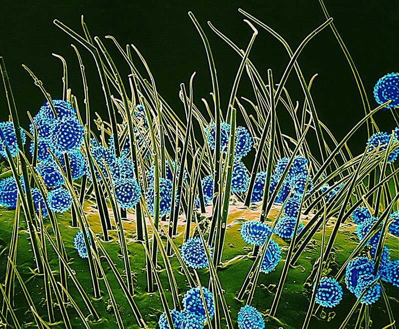 Pollen Grain Under the Microscope Stock Photo