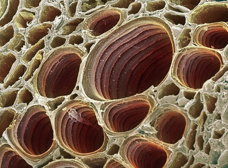 Xylem Plant Cell Under the Microscope