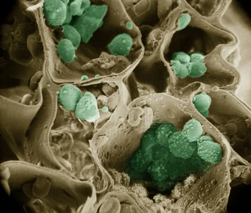 Leaf Edge Microscope Photo