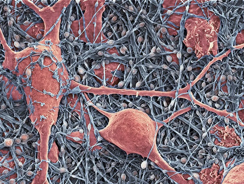 Nerve and Glial Cells Under the Microscope